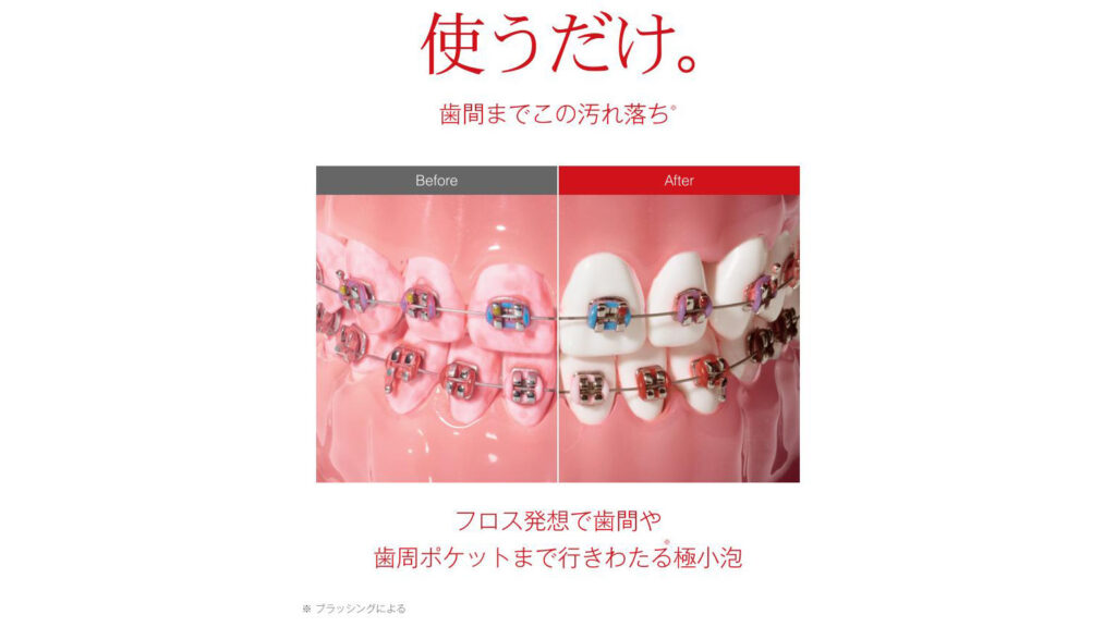 炭酸泡で磨き残しケア｜口臭・歯周病予防に『バブロス 炭酸泡ハミガキ』